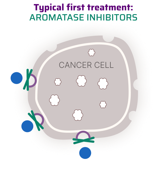 Illustration Of Aromatase Inhibitors Preventing Hormones From Attaching To An Untreated Cancer Cell